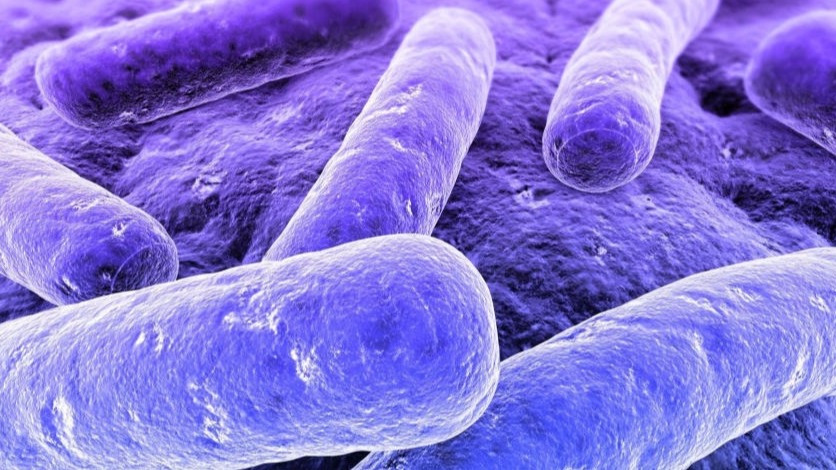legionella