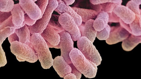 Control de plagas de microorganismos patógenos salmonela